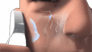icon Neuromodulation